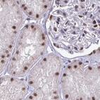 Anti-PUF60 Antibody