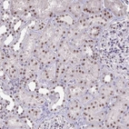 Immunohistochemical staining of human kidney shows strong nuclear positivity in cells in tubules.
