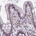 Immunohistochemical staining of human colon using Anti-PUF60 antibody HPA059714.