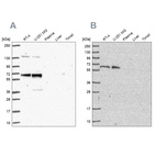 Western blot analysis using Anti-PUF60 antibody HPA059714 (A) shows similar pattern to independent antibody HPA052096 (B).