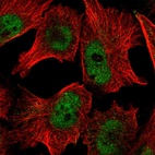Immunofluorescent staining of human cell line U-251 MG shows localization to nucleoplasm.
