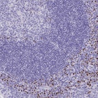 Anti-ANKDD1B Antibody