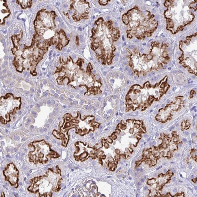 Anti-TP53I11 Antibody