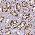Anti-TP53I11 Antibody