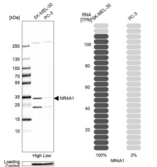 Anti-NR4A1 Antibody