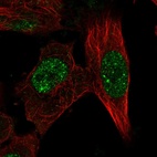 Immunofluorescent staining of human cell line U-251 MG shows localization to nucleoplasm & nuclear bodies.