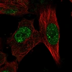 Immunofluorescent staining of human cell line U-251 MG shows localization to nucleoplasm & nuclear bodies.