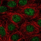 Immunofluorescent staining of human cell line MCF7 shows localization to nucleoplasm.