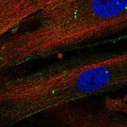 Anti-THBS1 Antibody