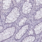 Immunohistochemical staining of human rectum shows no positivity in glandular cells as expected.