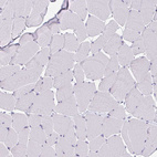 Anti-OR4A47 Antibody