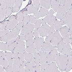 Immunohistochemical staining of human skeletal muscle shows no positivity in myocytes as expected.
