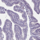 Immunohistochemical staining of human fallopian tube shows no positivity in glandular cells as expected.