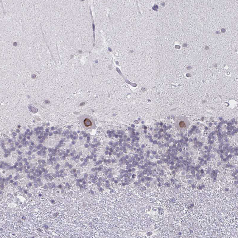 Anti-NUP133 Antibody