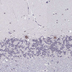 Anti-NUP133 Antibody