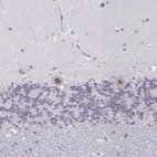 Anti-NUP133 Antibody