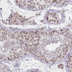 Anti-NUP133 Antibody