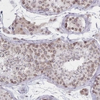 Immunohistochemical staining of human testis shows moderate positivity in nuclear membrane in cells in seminiferous ducts.
