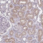Immunohistochemical staining of human kidney shows weak to moderate cytoplasmic positivity in cells in tubules.