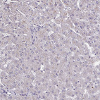 Immunohistochemical staining of human liver shows no positivity in hepatocytes as expected.