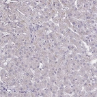 Immunohistochemical staining of human liver shows no positivity in hepatocytes as expected.