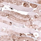 Immunohistochemical staining of human skeletal muscle shows moderate membranous positivity in myocytes.