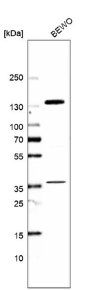 Western blot analysis in human cell line BEWO.