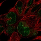 Immunofluorescent staining of human cell line RH-30 shows localization to nuclear membrane.