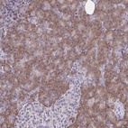 Anti-TMEM41A Antibody