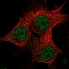 Anti-METTL16 Antibody