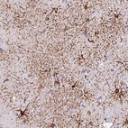 Anti-KIAA0368 Antibody