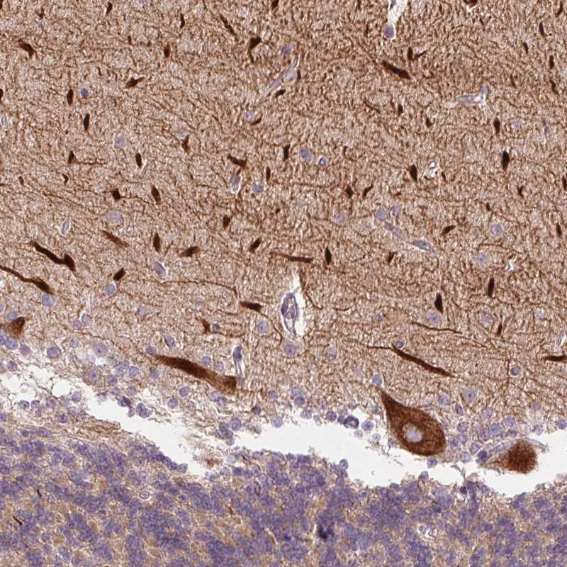 Anti-METTL17 Antibody