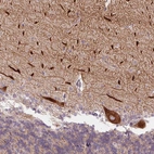Anti-METTL17 Antibody