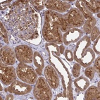 Anti-HDHD2 Antibody