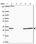 Lane 1: Marker [kDa] 250, 130, 95, 72, 55, 36, 28, 17, 10_br/_Lane 2: Human cell line RT-4_br/_Lane 3: Human cell line U-251MG sp_br/_Lane 4: Human plasma (IgG/HSA depleted)_br/_Lane 5: Human liver tissue_br/_Lane 6: Human tonsil tissue