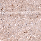 Immunohistochemical staining of human cerebral cortex shows moderate membranous positivity in a subset of neurons.
