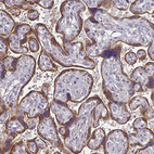 Anti-CTHRC1 Antibody