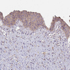 Anti-CTHRC1 Antibody