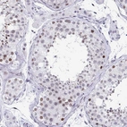 Immunohistochemical staining of human testis shows moderate nuclear positivity in cells in seminiferous ducts.