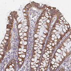 Anti-CTHRC1 Antibody