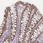 Immunohistochemical staining of human colon shows strong cytoplasmic positivity in glandular cells.