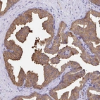 Immunohistochemical staining of human prostate shows strong cytoplasmic positivity in glandular cells.