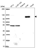 Western blot analysis in human cell line RT-4, human cell line U-251 MG, human plasma, human liver tissue and human tonsil tissue.