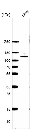 Western blot analysis in human liver tissue.