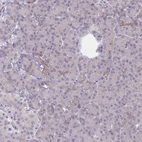 Immunohistochemical staining of human pancreas shows low positivity in exocrine glandular cells as expected.