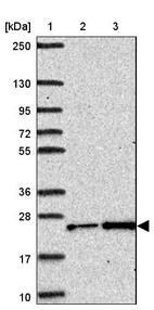 Lane 1: Marker [kDa] 250, 130, 95, 72, 55, 36, 28, 17, 10_br/_Lane 2: Human cell line RT-4_br/_Lane 3: Human cell line U-251MG sp