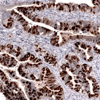 Immunohistochemical staining of human fallopian tube shows strong cytoplasmic positivity in glandular cells.