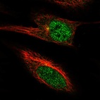 Anti-PGBD4 Antibody