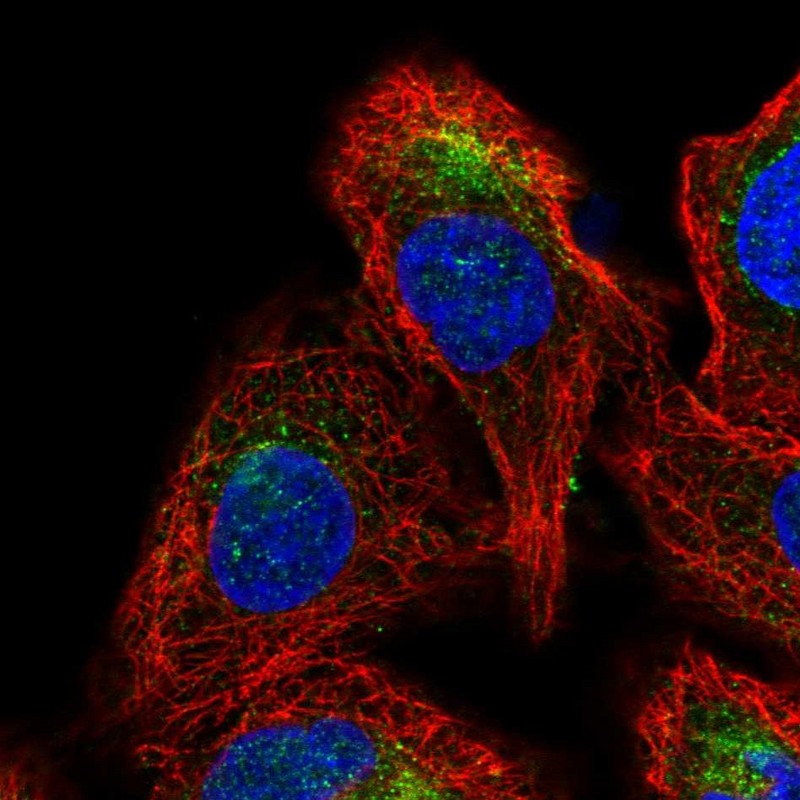 Anti-GDPGP1 Antibody