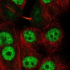 Anti-LYRM1 Antibody